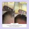 Scalp & Hair Oil with Bacuri butter & Castor Oil
